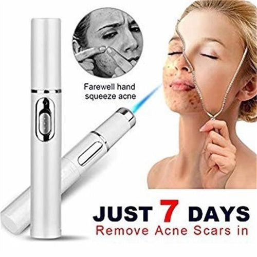 "Blue Light Acne Treatment Pen"
