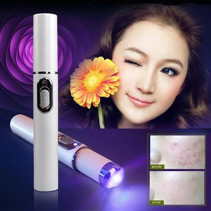"Blue Light Acne Treatment Pen"
