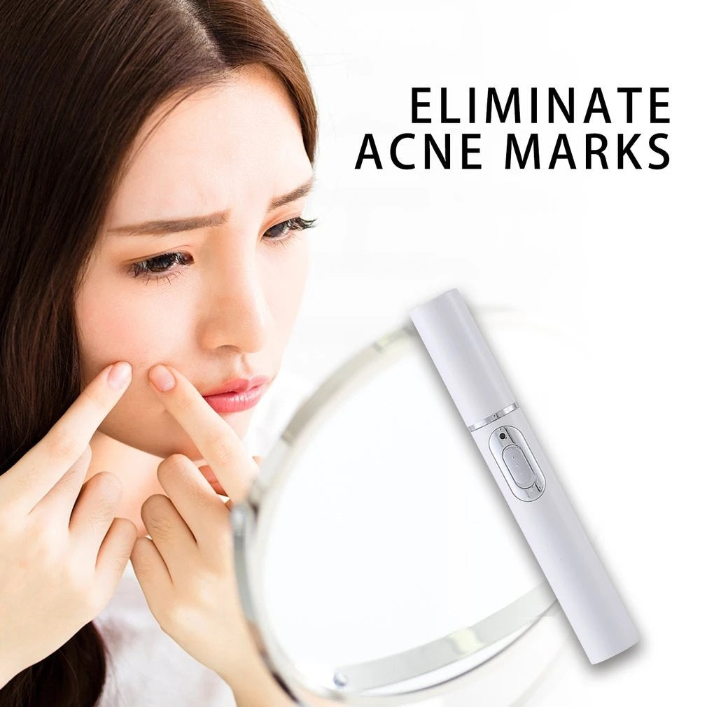 "Blue Light Acne Treatment Pen"